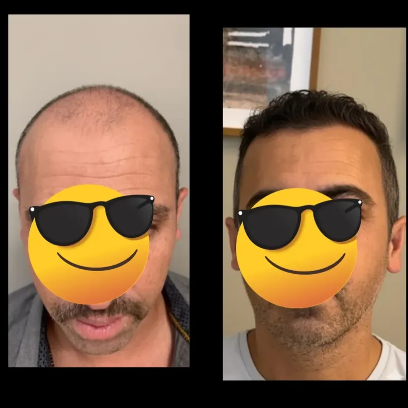 Resultado Rodrigo