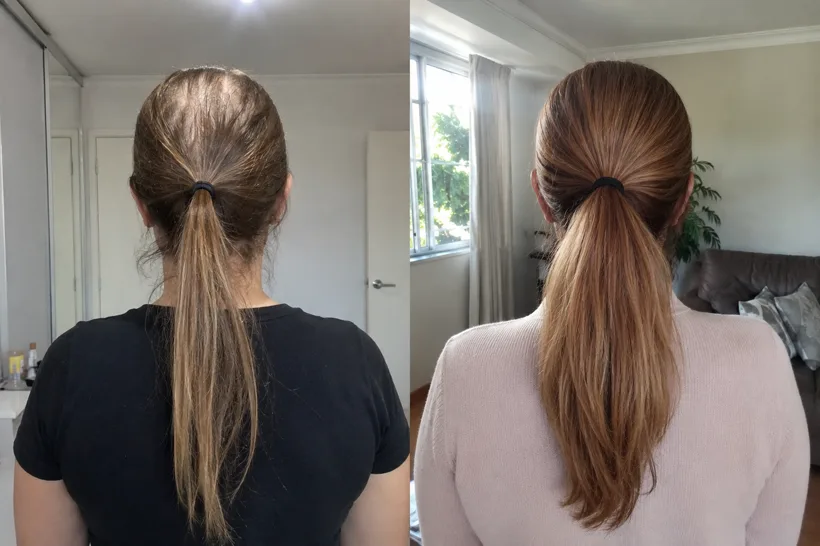 Antes e depois de Carolina Sarmento, 46 anos, cabelo preso, vista de trás