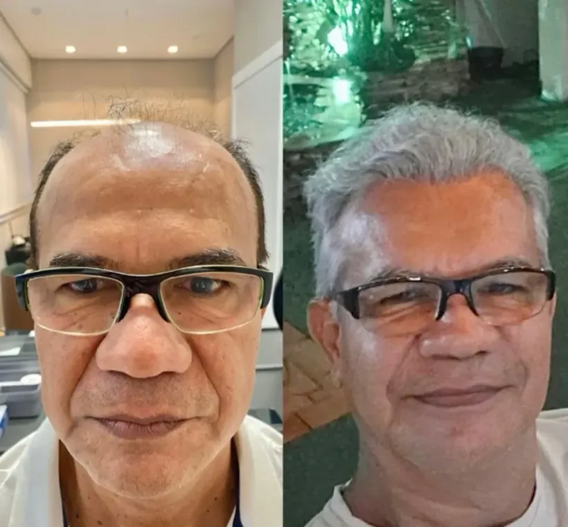 Resultado de José Nascimento