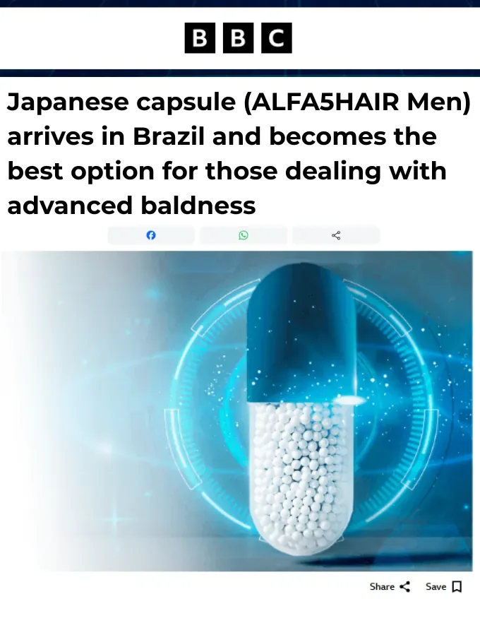 Print de matéria internacional sobre a tecnologia japonesa de calvície
