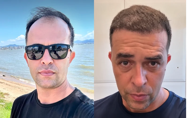 Antes e depois enviado por Roberto Mendes